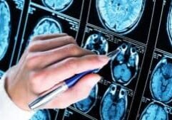 A hand holding a pen points at a series of brain scan images, likely MRI or CT scans, displayed on a screen or film. The scans show cross-sectional views of the human brain.